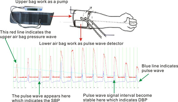 How Does Pulse Wave Blood Pressure Monitor Measure?